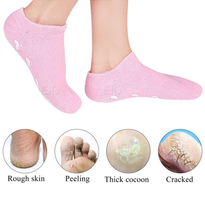 Chaussettes de gel de spa en silicone,soin des pieds, hydratant,protection de la peau fissurée – Image 3