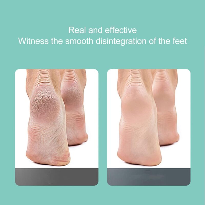Machine Électrique pour Soins des Pieds, Appareil pour Enlever les Cuticules Mortes et Sèches – Image 2