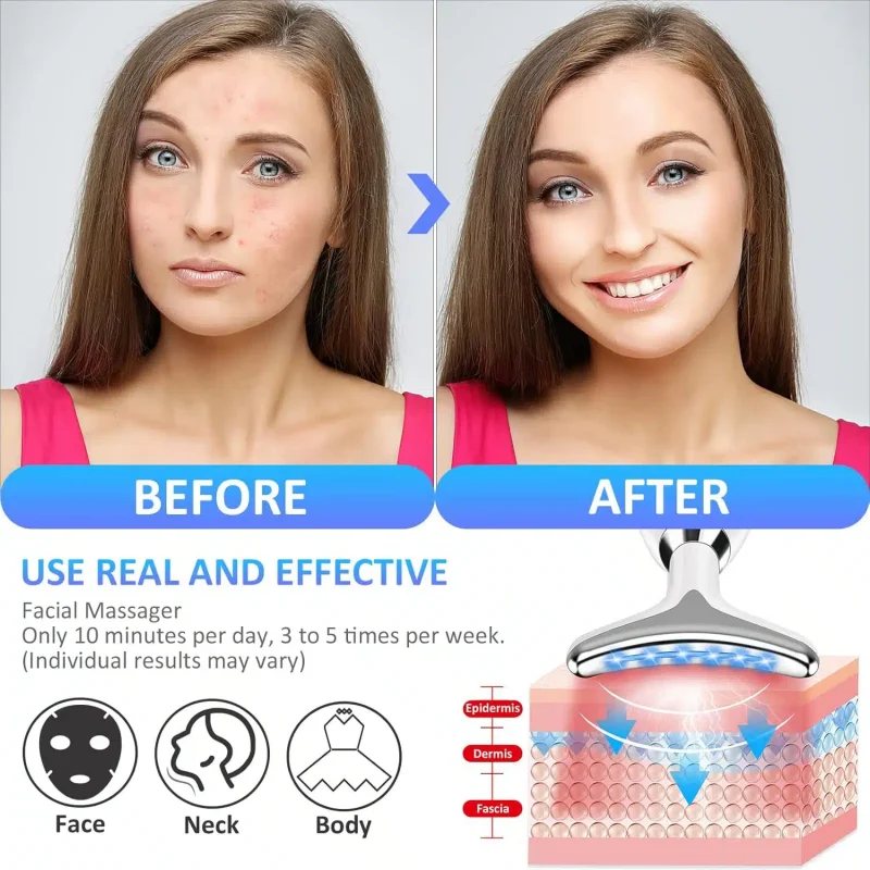 Appareil Anti Rides Visage, 7 Couleurs de Massage Visage,3 Modes cou Raffermissement du Visage – Image 4